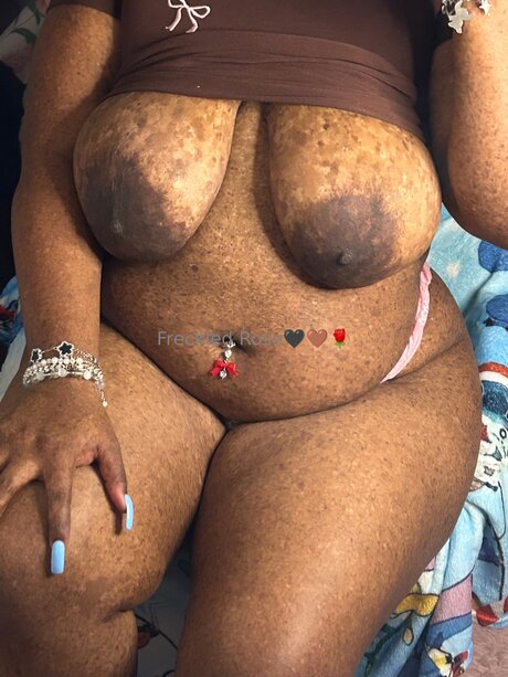Freckledfantasy5
