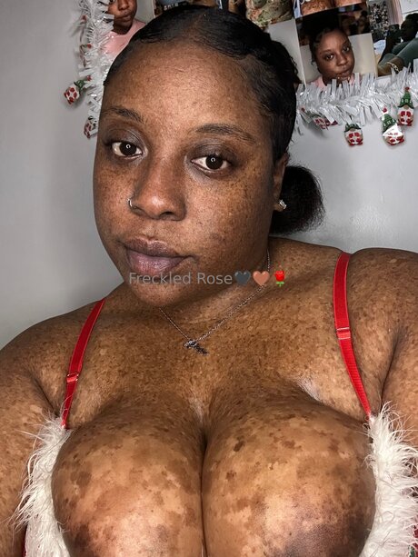 Freckledfantasy5
