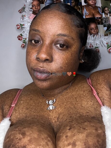 Freckledfantasy5