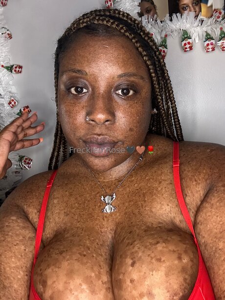Freckledfantasy5