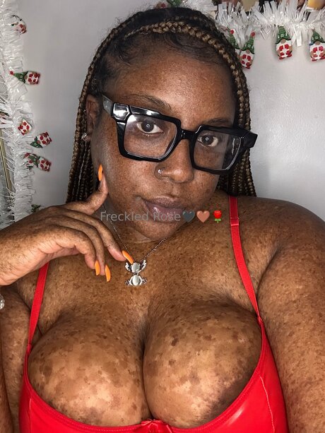 Freckledfantasy5