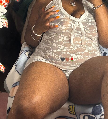 Freckledfantasy5