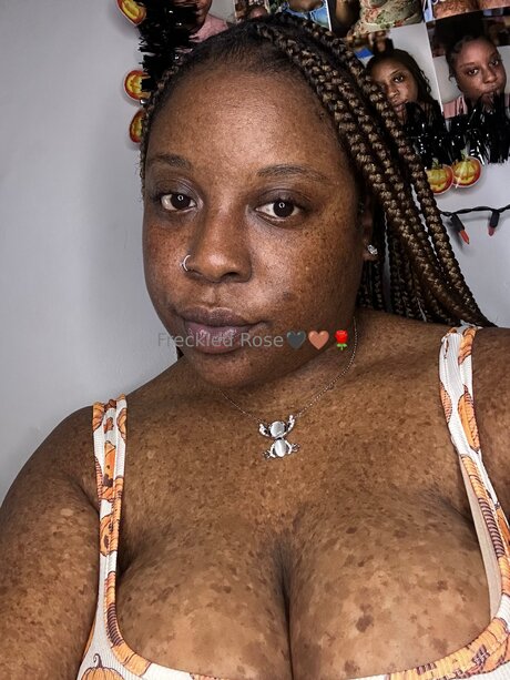 Freckledfantasy5