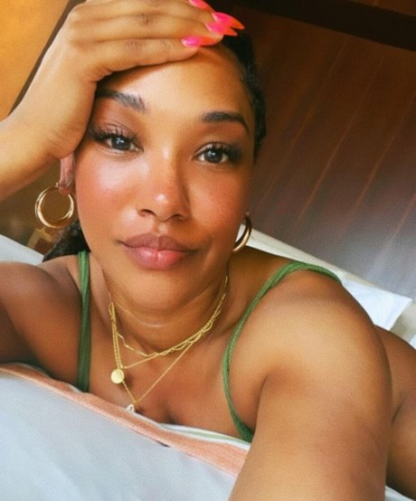 Candice Patton