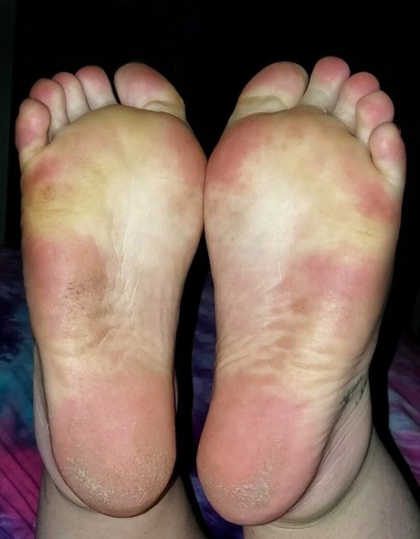 Erinjensoles