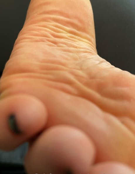 Misspiggytoes
