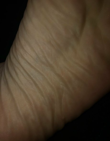 Toetalvixen