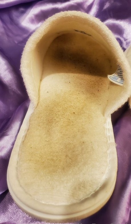 Missfeetstink