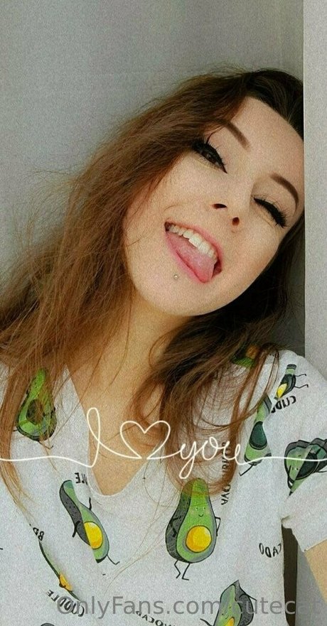 Mi_ameli